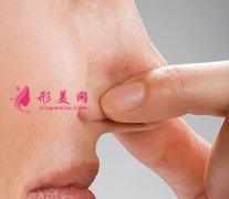 鼻翼縮小手術的方法有哪些？