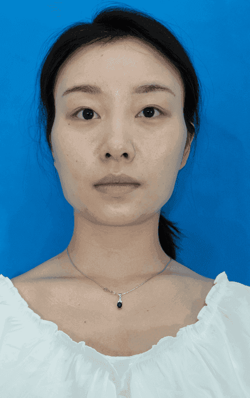 江蘇施爾美整形美容醫(yī)院怎么樣？附拉皮術(shù)后效果對比及2021價格表公開