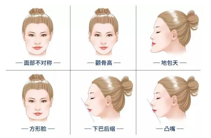 上海九院整形科輪廓整形價格 上海九院整形科輪廓整形價格