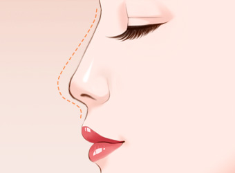 上海九院整形科眼鼻整形價格 上海九院整形科眼鼻整形價格