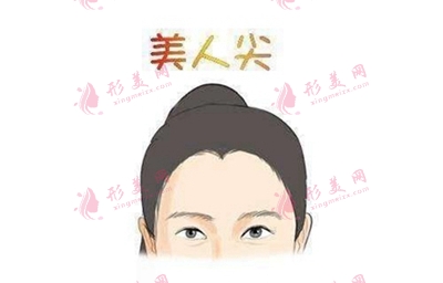 廣州科發(fā)源美人尖種植費用是多少 廣州科發(fā)源美人尖種植費用是多少
