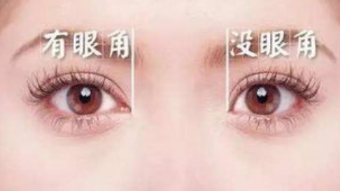 開眼角之后吃什么有助于恢復(fù)？開眼角后多久可以化妝？