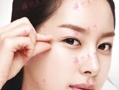 不適合做雙眼皮的四類單眼皮女生！