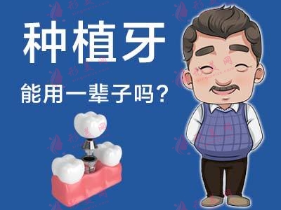 2022種植牙收費價格表公布！多少錢一顆？優(yōu)點、適合人群全科普！