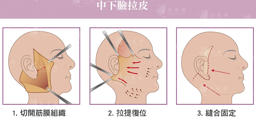 上海第九人民醫(yī)院拉皮多少錢？緊膚除皺項(xiàng)目介紹及價(jià)格表
