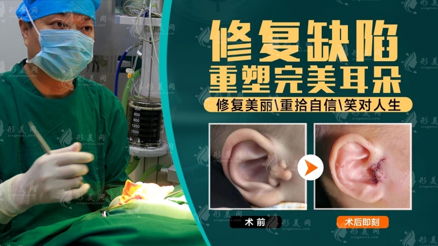做耳朵畸形手術(shù)可以報(bào)銷嗎?這些耳再造醫(yī)院有補(bǔ)助政策