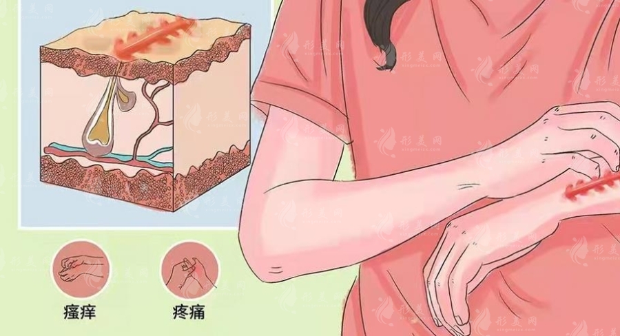 北京麗合醫(yī)療美容醫(yī)院疤痕科怎么樣？修復(fù)案例&專家信息&收費(fèi)標(biāo)準(zhǔn)