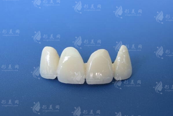 烤瓷牙價(jià)格和種類(lèi)有哪些？哪種效果比較好？科普知識(shí)一覽