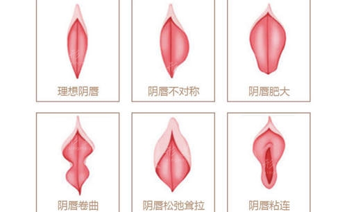 南京私密整形醫(yī)院在哪里?排名名單康美/美貝爾顧客滿意度高
