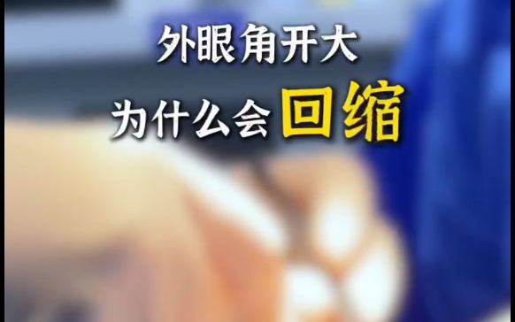 想知道為什么外眼角開大會回縮嗎？杜園園醫(yī)生來為您解答