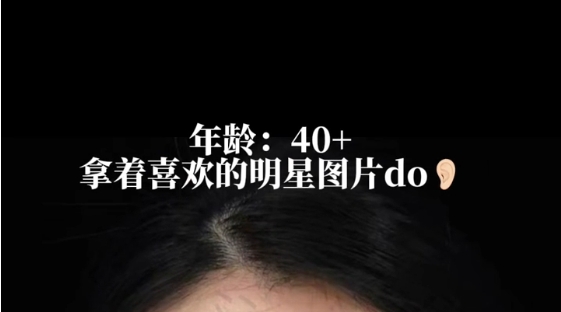 40+耳周抗衰前后對比，值不值呢？劉浩存同款