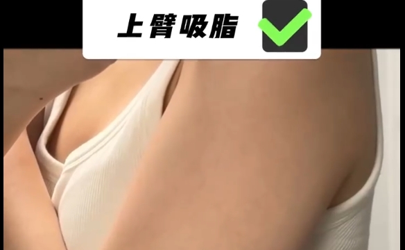 吸脂后上癮的原因是什么？程辰醫(yī)生為你解開疑團(tuán)