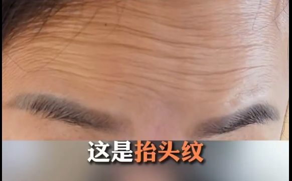 明明都是抬頭紋，為什么改善的方式不一樣？