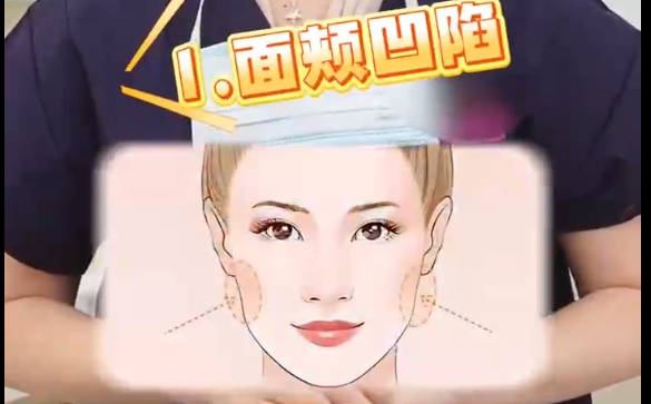 肉毒素再好，這兩種人統(tǒng)統(tǒng)勸退？魏皎醫(yī)生告訴你 