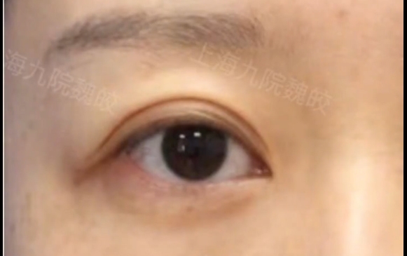 這種眼睛除了做提眉，其他什么也別做！