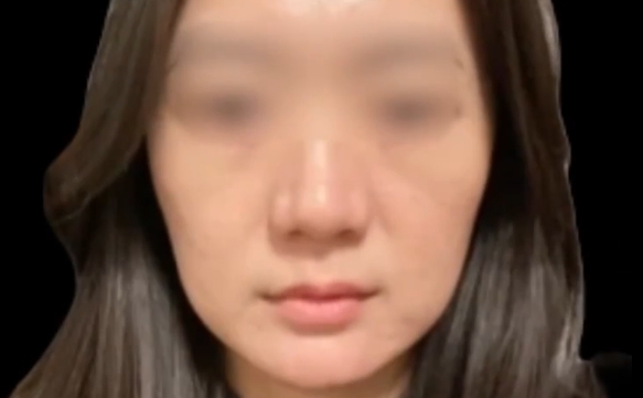 30+年齡女性值得嘗試的3個醫(yī)美項(xiàng)目，魏皎醫(yī)生詳細(xì)解讀