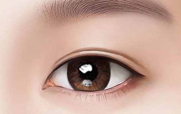 如何正確看待眼修復(fù)早期腫脹？杜園園醫(yī)生在線解析