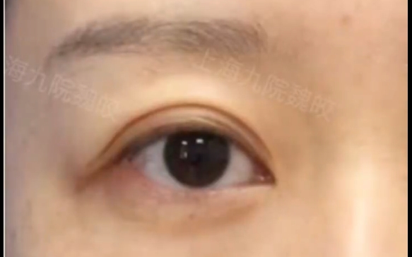 這種眼睛除了提眉，其他的什么都別做！