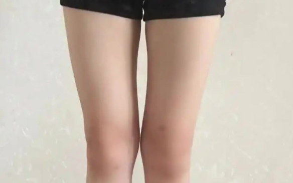 腿圍多少算粗？看完你就不焦慮了