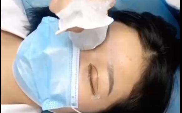 7個雙眼皮恢復(fù)期的壞習(xí)慣，別再犯了！馮少清醫(yī)生教你正確護理