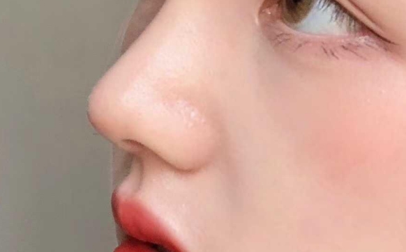 隆鼻三大謠言，你被騙了多久？