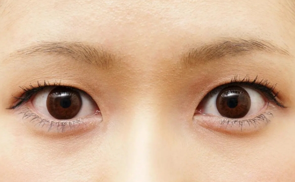 所有上瞼下垂都會(huì)遺傳嗎？周顯玉醫(yī)生為你解答