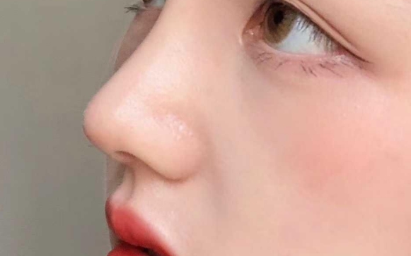 初鼻為什么不做肋軟骨？魏皎醫(yī)生告訴你