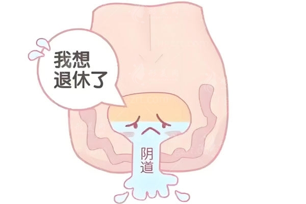 半島熱瑪吉可以做私密緊縮:深度分析和盆底肌治療儀/少女針的區(qū)別