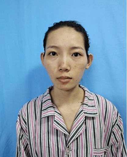 鄭州壹加壹做面部拉皮 鄭州壹加壹做面部拉皮