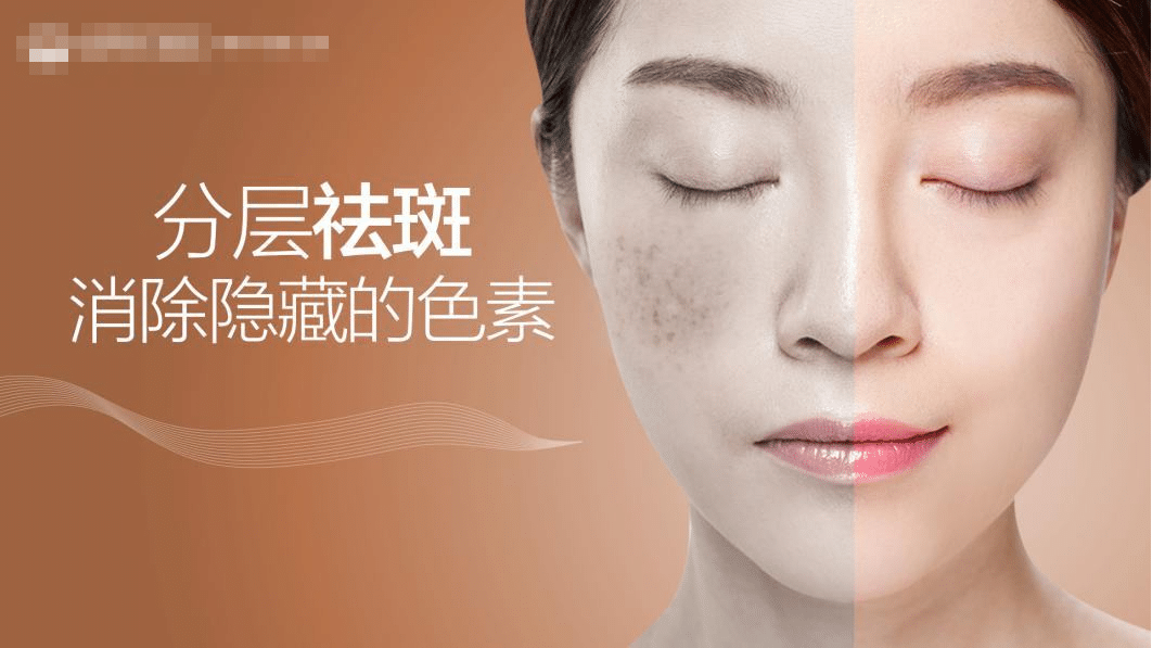 激光祛斑會(huì)留疤嗎 激光祛斑會(huì)留疤嗎