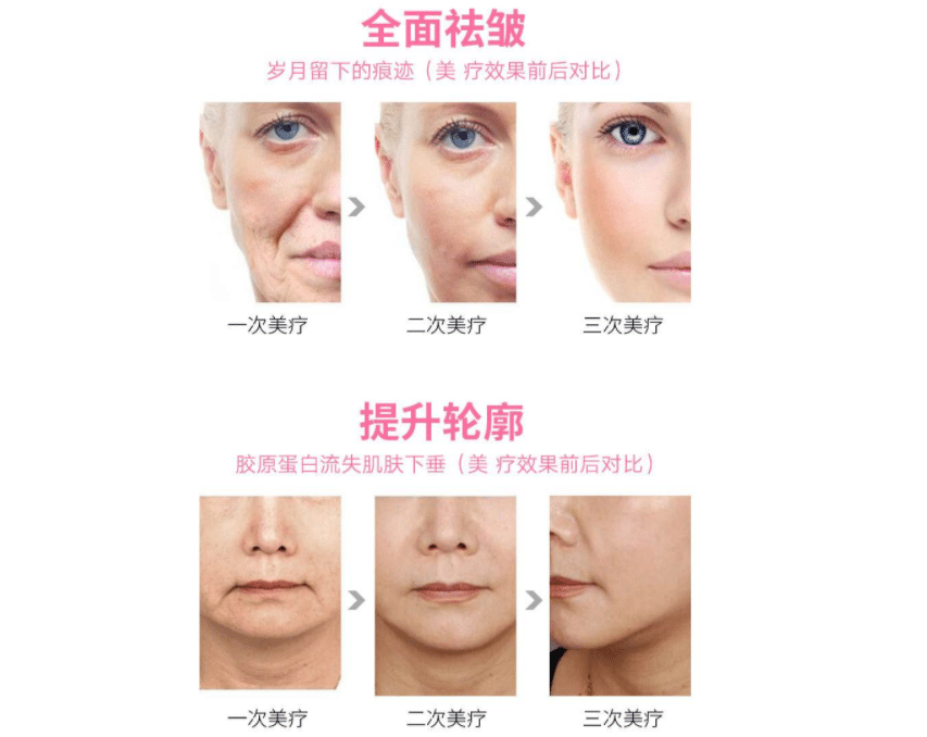 提升抗鄒