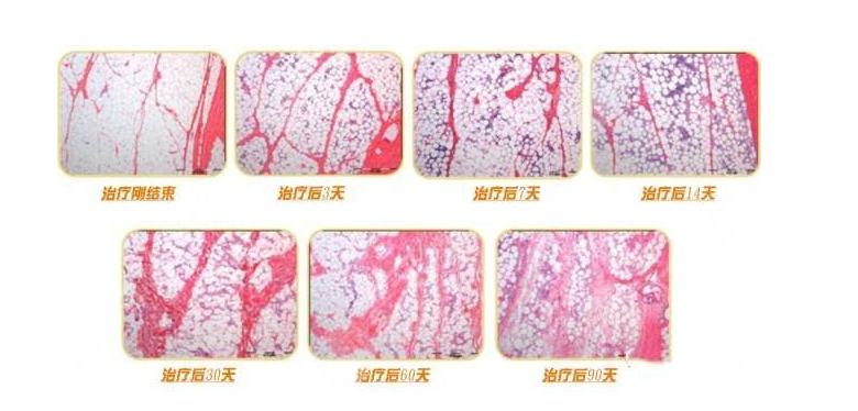 超塑脂是什么？