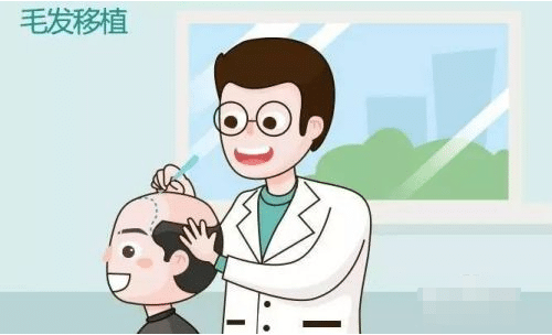毛發(fā)移植 毛發(fā)移植