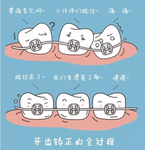 牙齒矯正的價格是多少 哪種方法比較好