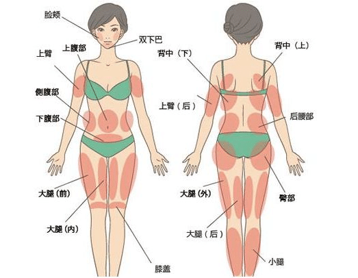 全身吸脂多少錢 全身吸脂多少錢