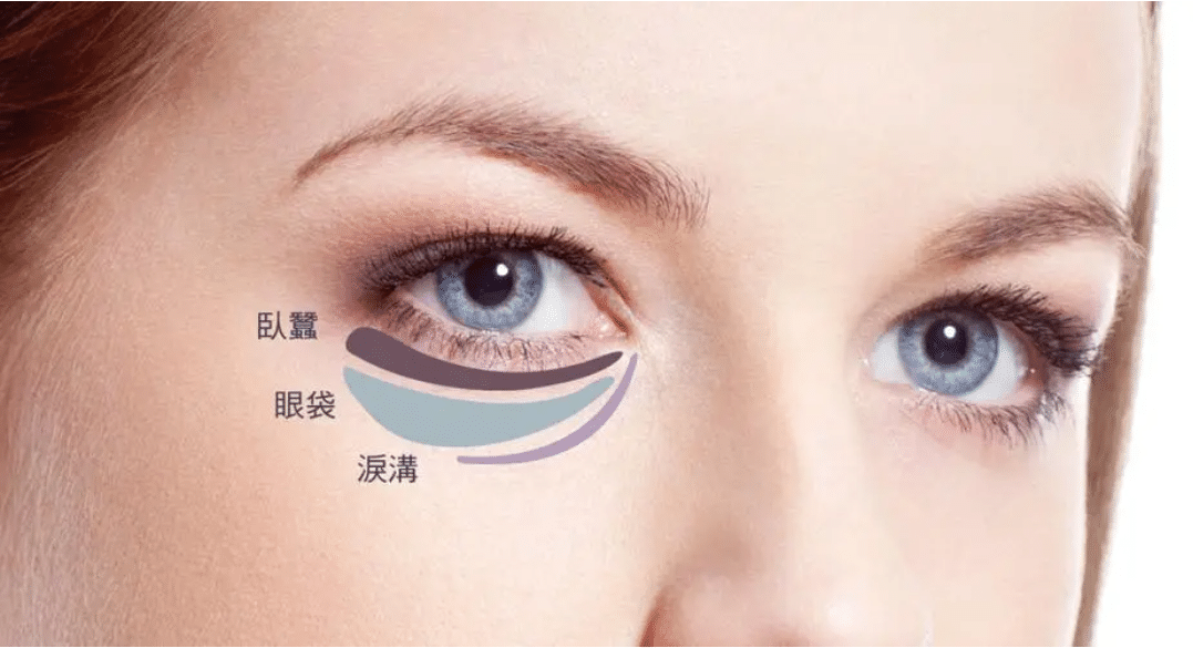 吸脂祛眼袋 吸脂祛眼袋