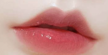 豐唇 豐唇