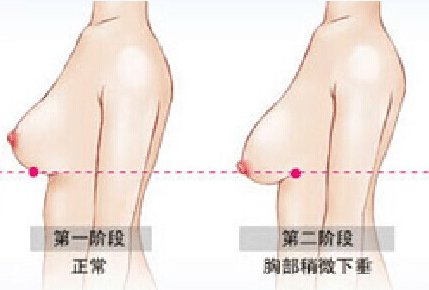 胸部 胸部