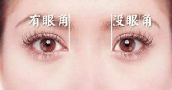 近視眼能做開(kāi)眼角手術(shù)嗎？