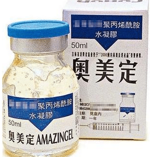 還有人不知道奧美定嗎？奧美定取出后可以放假體嗎？