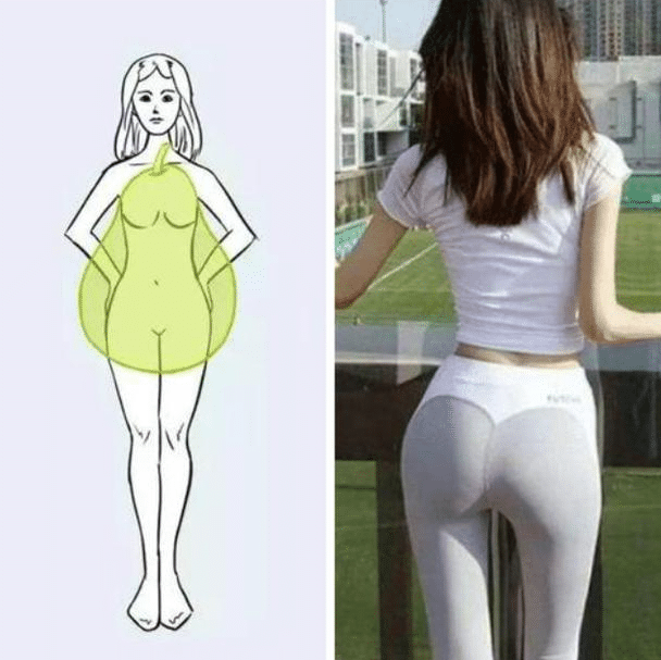 大腿吸脂 大腿吸脂