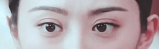 雙眼皮 雙眼皮