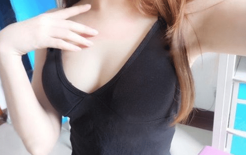 自體脂肪豐胸術(shù)后一個月 自體脂肪豐胸術(shù)后一個月