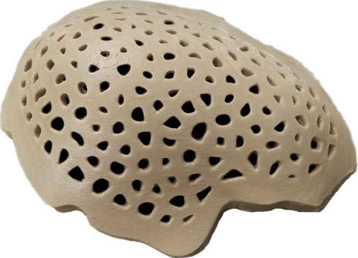 3D打印生物材料Peek 3D打印生物材料Peek
