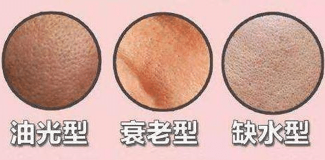 毛孔粗大的類型 毛孔粗大的類型