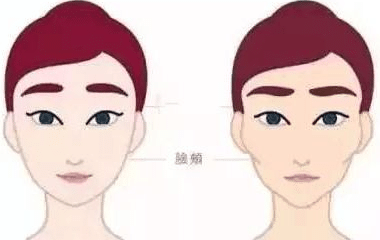 面部填充 面部填充
