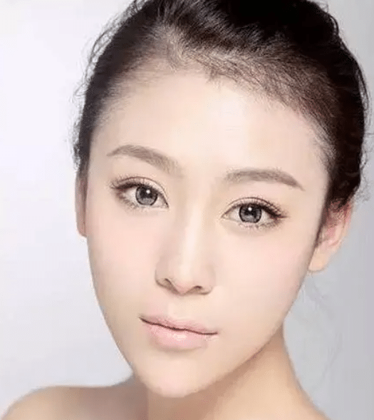 瓜子臉 瓜子臉
