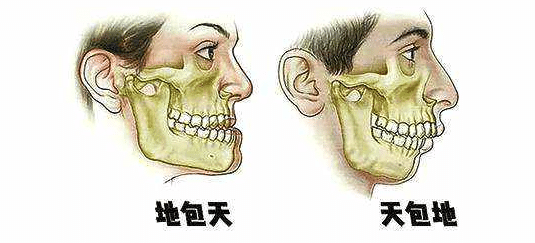 天包地圖片 天包地圖片