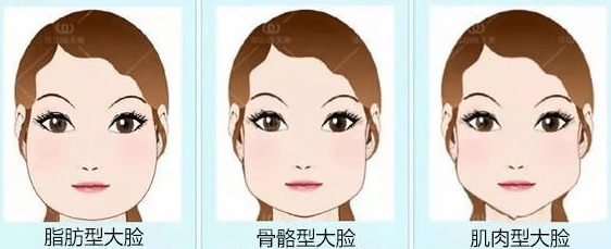 瘦臉的分類 瘦臉的分類
