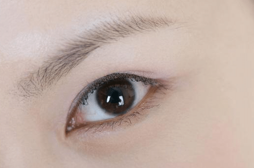 激光洗眉 激光洗眉